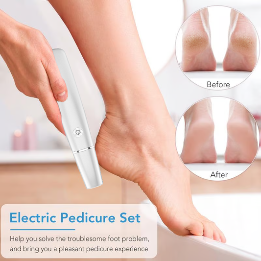 🔥Today Special Price ￡9.99!!🔥Electric Feet Callus Remover