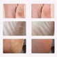 🔥Time-limited Special Price ￡9.99!!🦶Electric Feet Callus Remover